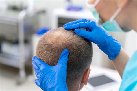 Haartransplantatie En Rimpels: Wat Je Moet Weten